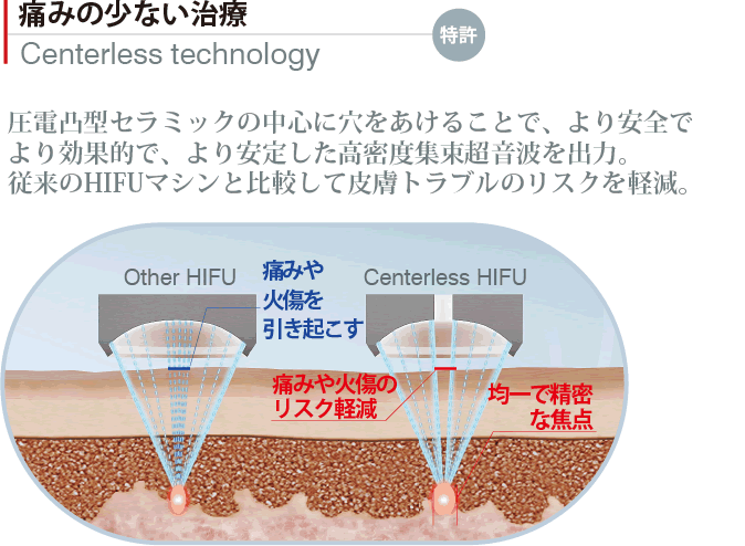 痛みの少ない治療