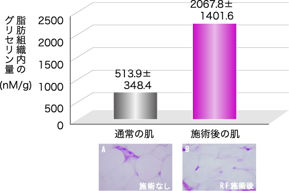 脂肪分解効果